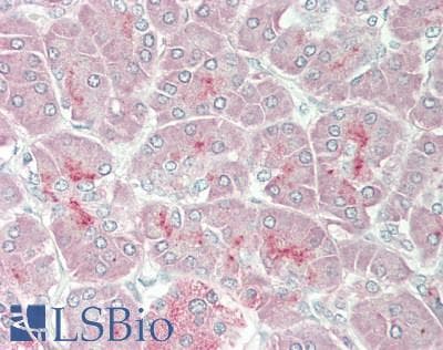 ARSE / Arylsulfatase E Antibody (aa504-553)