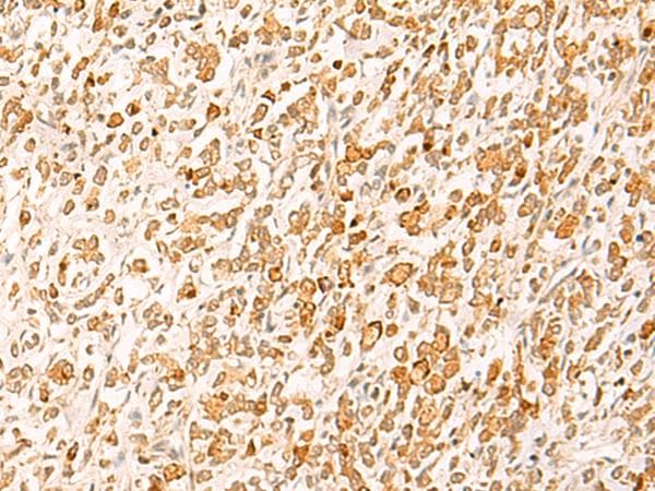 HTT / Huntingtin Antibody