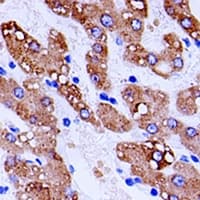 Polyclonal Rabbit anti-Human UGT2B10 Antibody (IHC, WB)