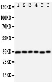 Polyclonal Rabbit anti-Human AQP4 / Aquaporin 4 Antibody (aa258-274, IHC, WB)