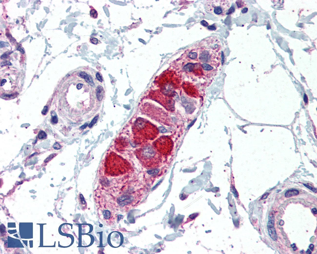 ABCA1 Antibody (DY650)