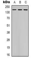 DAPK1 / DAP Kinase Antibody (Internal)