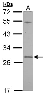 SNAP23 / SNAP-23 Antibody