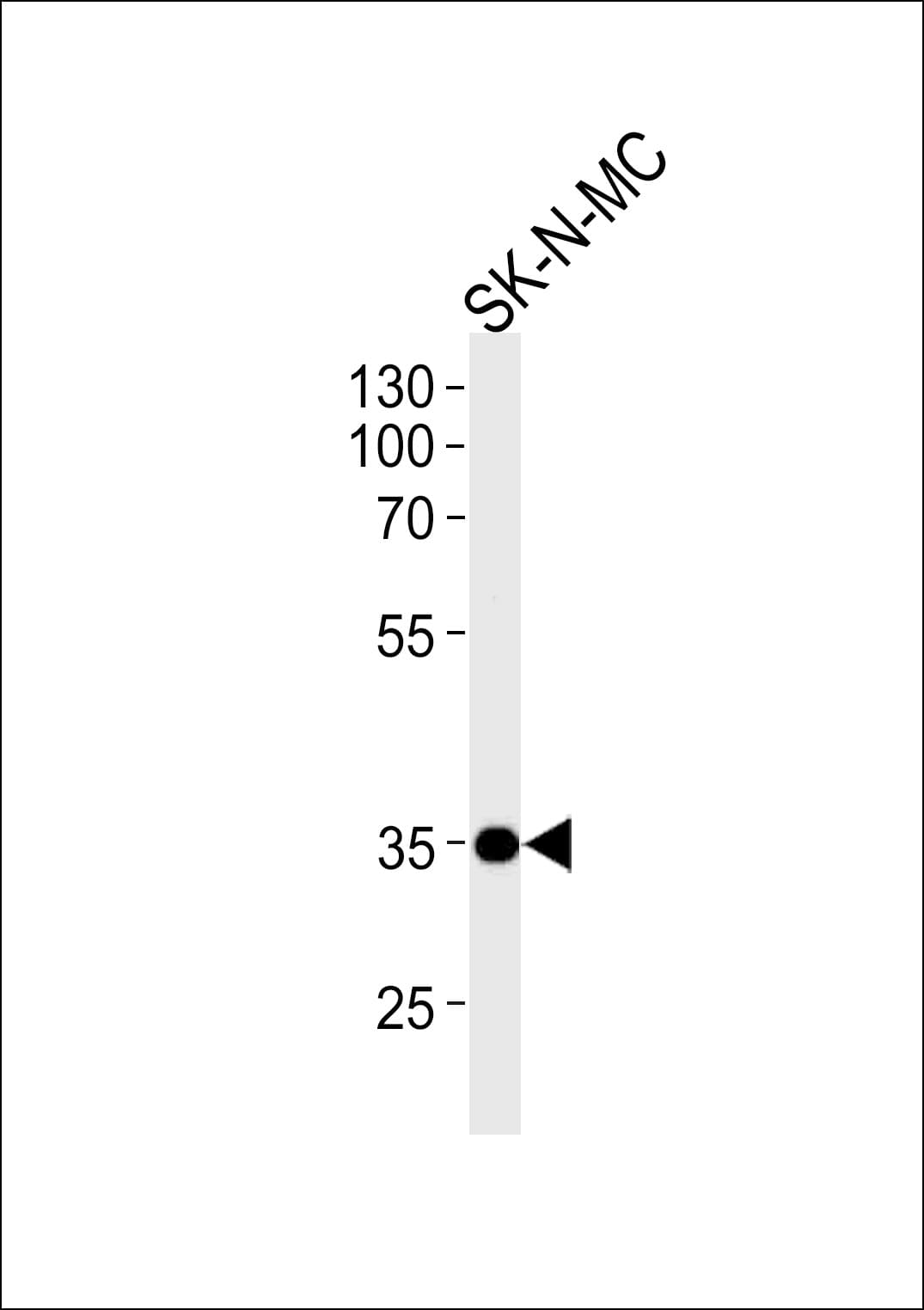 NKX1-1 Antibody (aa230-258)