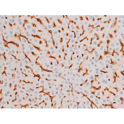 FOXO4 / AFX1 Antibody (phospho-Ser197)