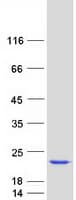 Human RFK Protein (Recombinant Myc-DDK (Flag))