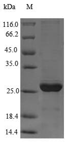 Giardia lamblia gag Protein (Recombinant 6His, N-terminus)