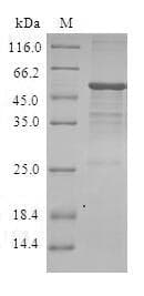 Human DIRAS3 / ARHI Protein (Recombinant GST, N-terminus)