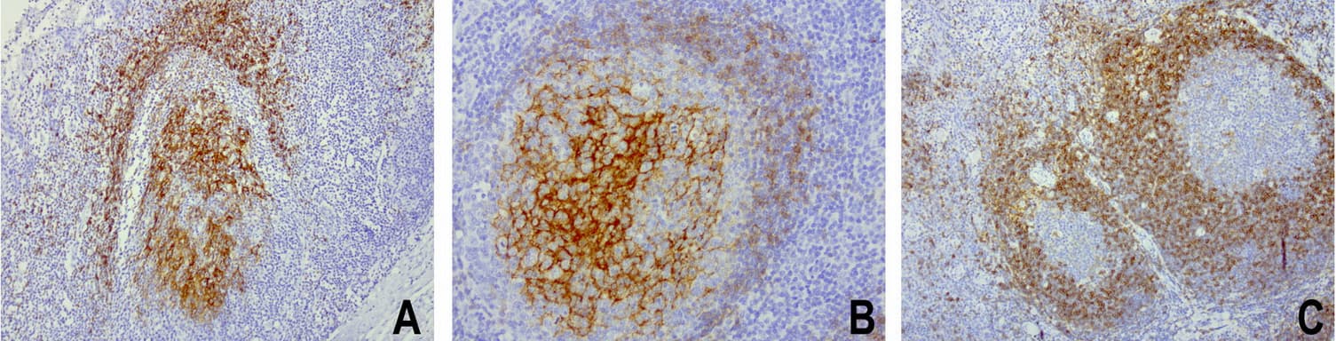 FCER2 / CD23 Antibody (aa48-321, clone UMAB101)