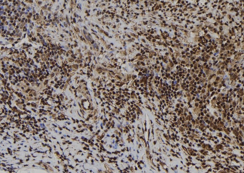 Polyclonal Rabbit anti-Human ATRAID / C2orf28 Antibody (IHC, WB)