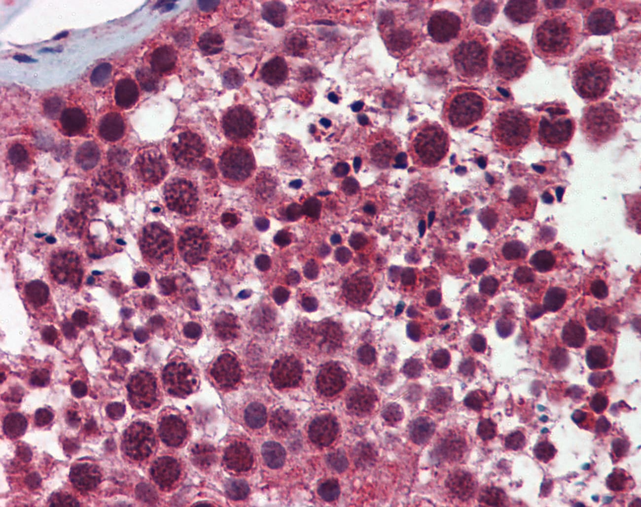 Polyclonal Rabbit anti-Human SELS Antibody (aa72-121, IHC, WB)