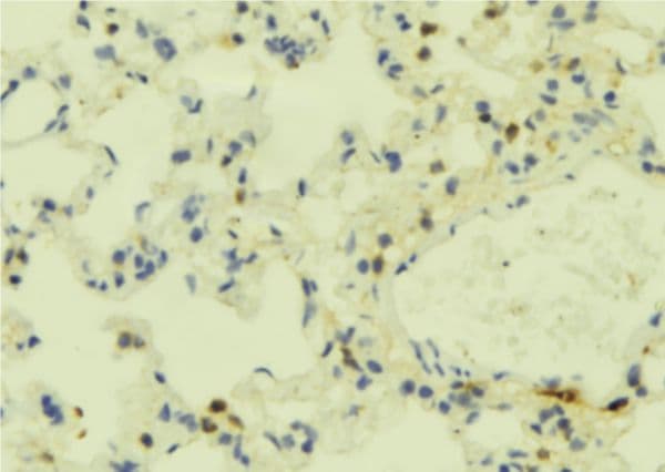 Polyclonal Rabbit anti-Human FPR2 / FPRL1 Antibody (IHC, WB)