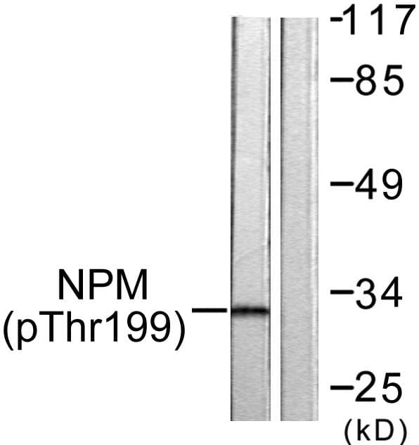 NPM1 / NPM / Nucleophosmin Antibody (phospho-Thr199)