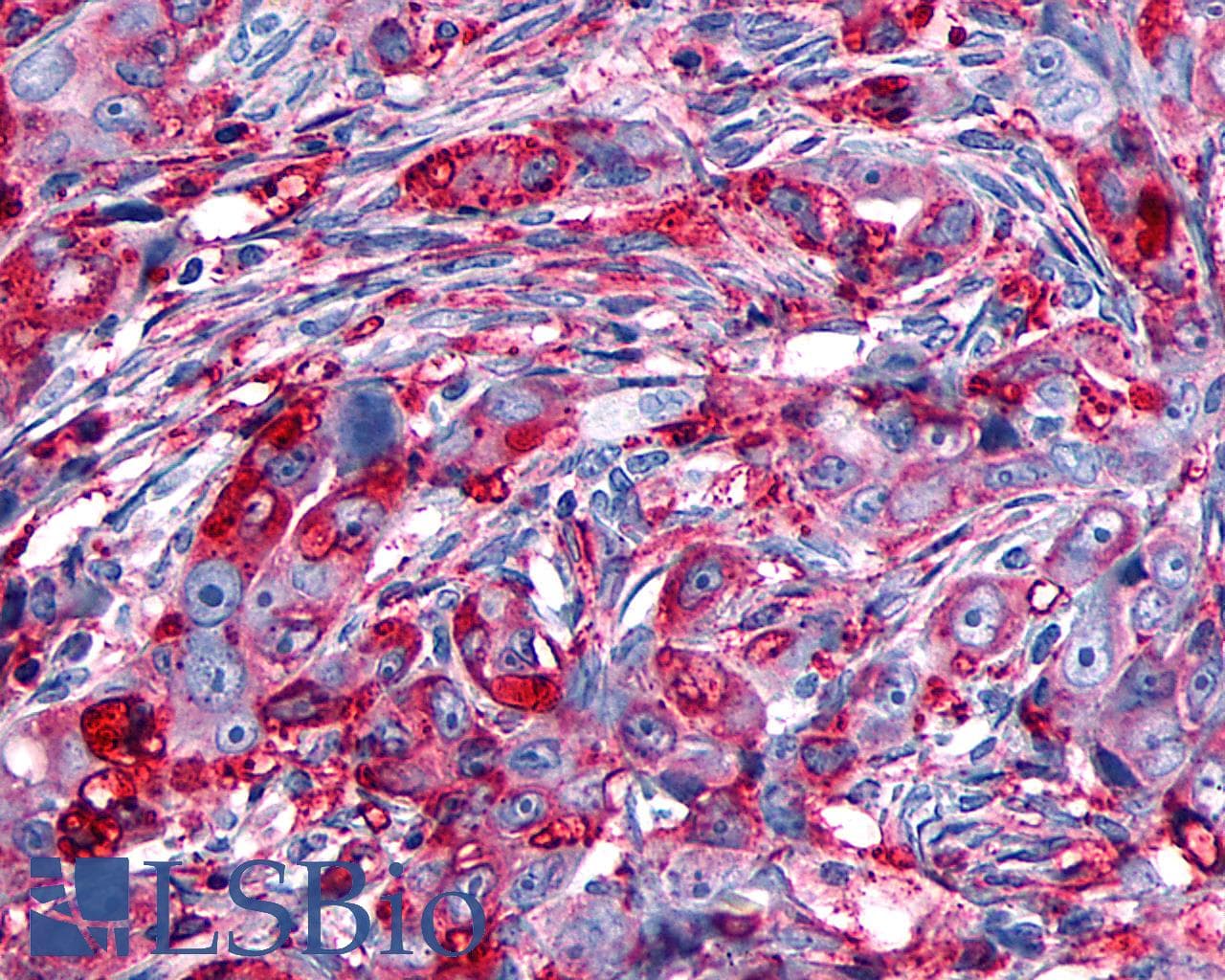 PathPlus™ ADGRD1 / GPR133 Antibody (Cytoplasmic Domain)