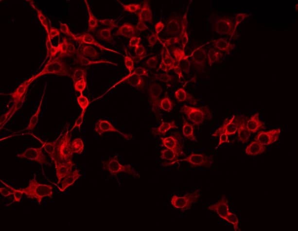Polyclonal Rabbit anti-Human PEX11B Antibody (IF, WB)