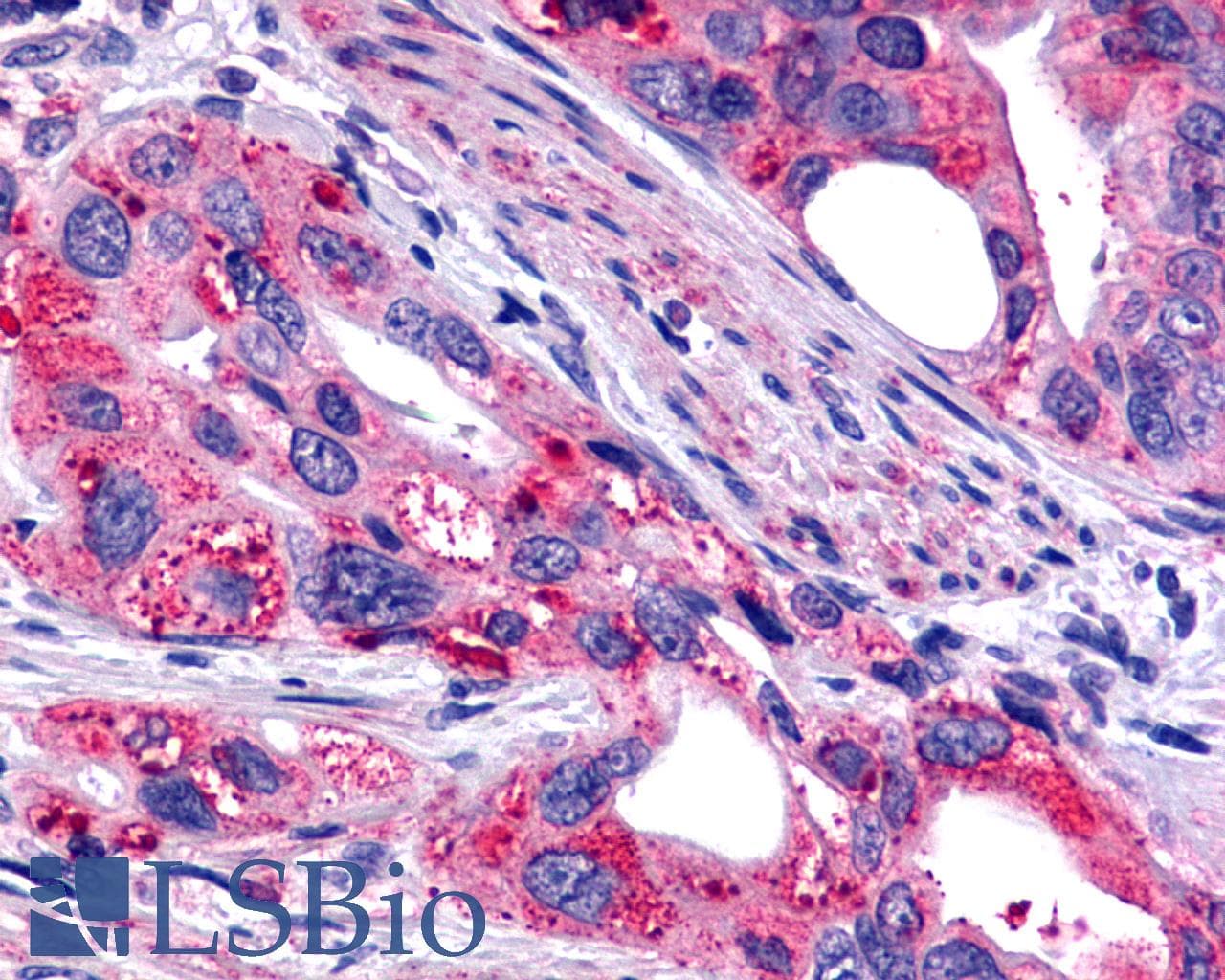 PathPlus™ Polyclonal Rabbit anti-Human GALR2 / Galanin Receptor 2 Antibody (Transmembrane Domain, IHC)