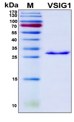 Human VSIG1 Protein (Recombinant 6His, N-terminus)