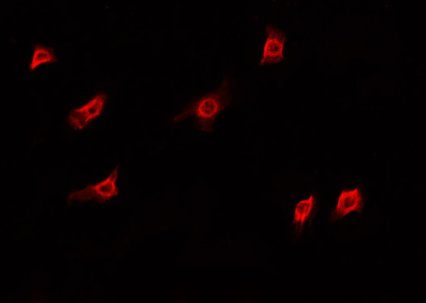 Polyclonal Rabbit anti-Human DKC1 / Dyskerin Antibody (IF, WB)