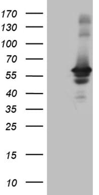 Monoclonal Mouse anti-Human RAB3IP / RABIN3 Antibody (clone OTI4A7, WB)