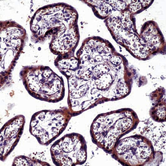 Polyclonal Rabbit anti-Human MMP9 / Gelatinase B Antibody (Internal, IHC)