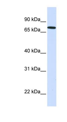 SETDB2 Antibody (aa71-120)
