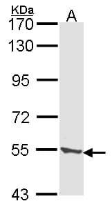 TPP1 / CLN2 Antibody (aa224-563)