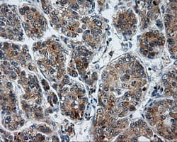 LIPG / Endothelial Lipase Antibody (clone OTI8F8)