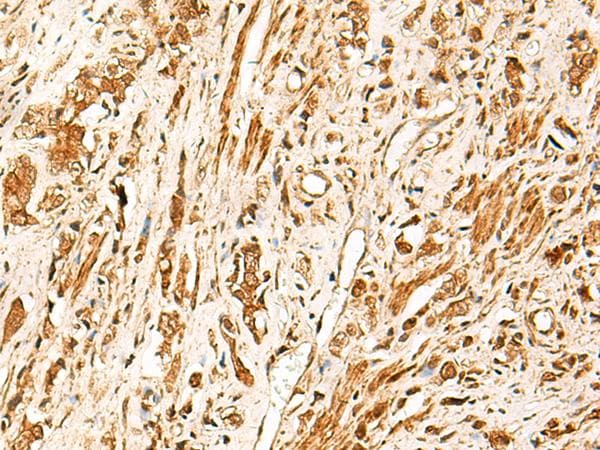 Polyclonal Rabbit anti-Human TCF7 Antibody (IHC)