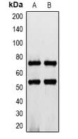 IL7R / CD127 Antibody (C-Terminus)