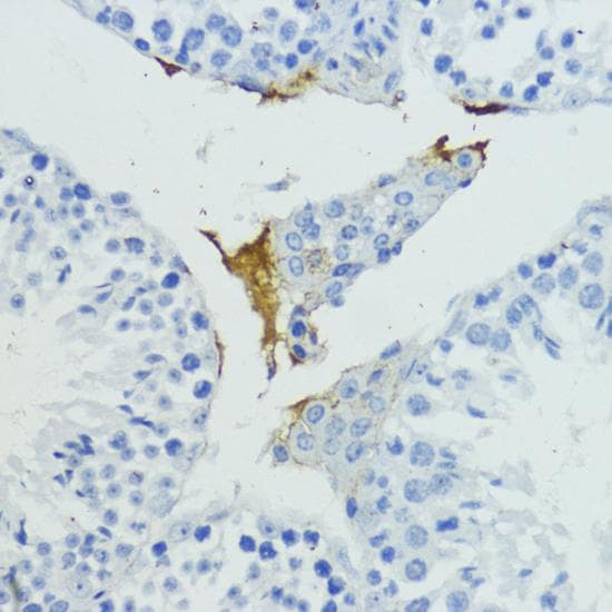 KLKB1 / Plasma Kallikrein Antibody