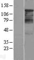 HDAC4 Protein (Over-Expression Lysate Myc-DDK (Flag))