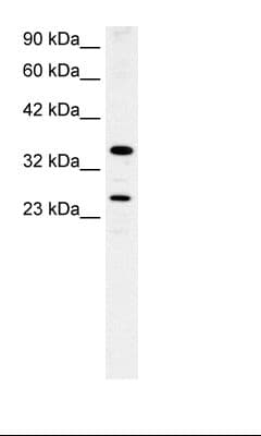 ASGR2 Antibody (aa71-120)