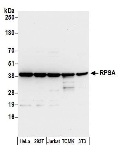 RPSA / Laminin Receptor Antibody (aa1-50)