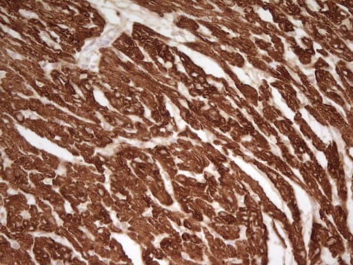 Monoclonal Mouse anti-Human TNNT2 / CTNT Antibody (clone OTI3C3, IHC, WB)
