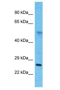 Polyclonal Rabbit anti-Human MMD2 Antibody (aa3-52, WB)