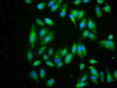 Polyclonal Rabbit anti-Human EIF3I / EIF3S2 Antibody (IHC, WB)