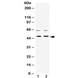 HNRNPH1 / hnRNP H Antibody