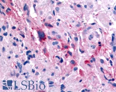 PathPlus™ GPR32 Antibody (Extracellular Domain)