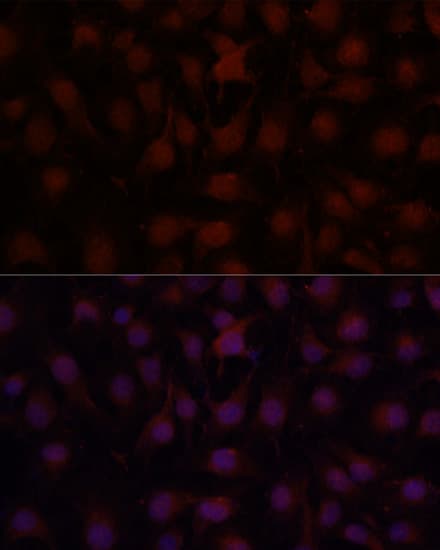Polyclonal Rabbit anti-Human CD34 Antibody (IF, WB)