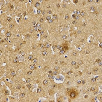 BAIAP2 / IRSP53 Antibody