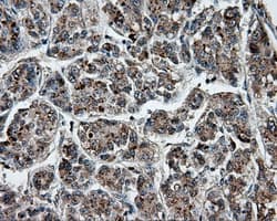 Monoclonal Mouse anti-Human PTPRE / PTP Epsilon Antibody (clone OTI4B2, IHC, IF, WB)