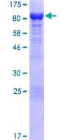 Human Neurochondrin Protein (Recombinant GST)