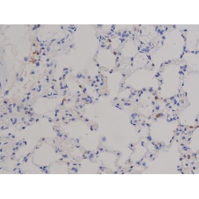 Polyclonal Rabbit anti-Human STAT1 Antibody (phospho-Tyr701, IHC, IF, WB)