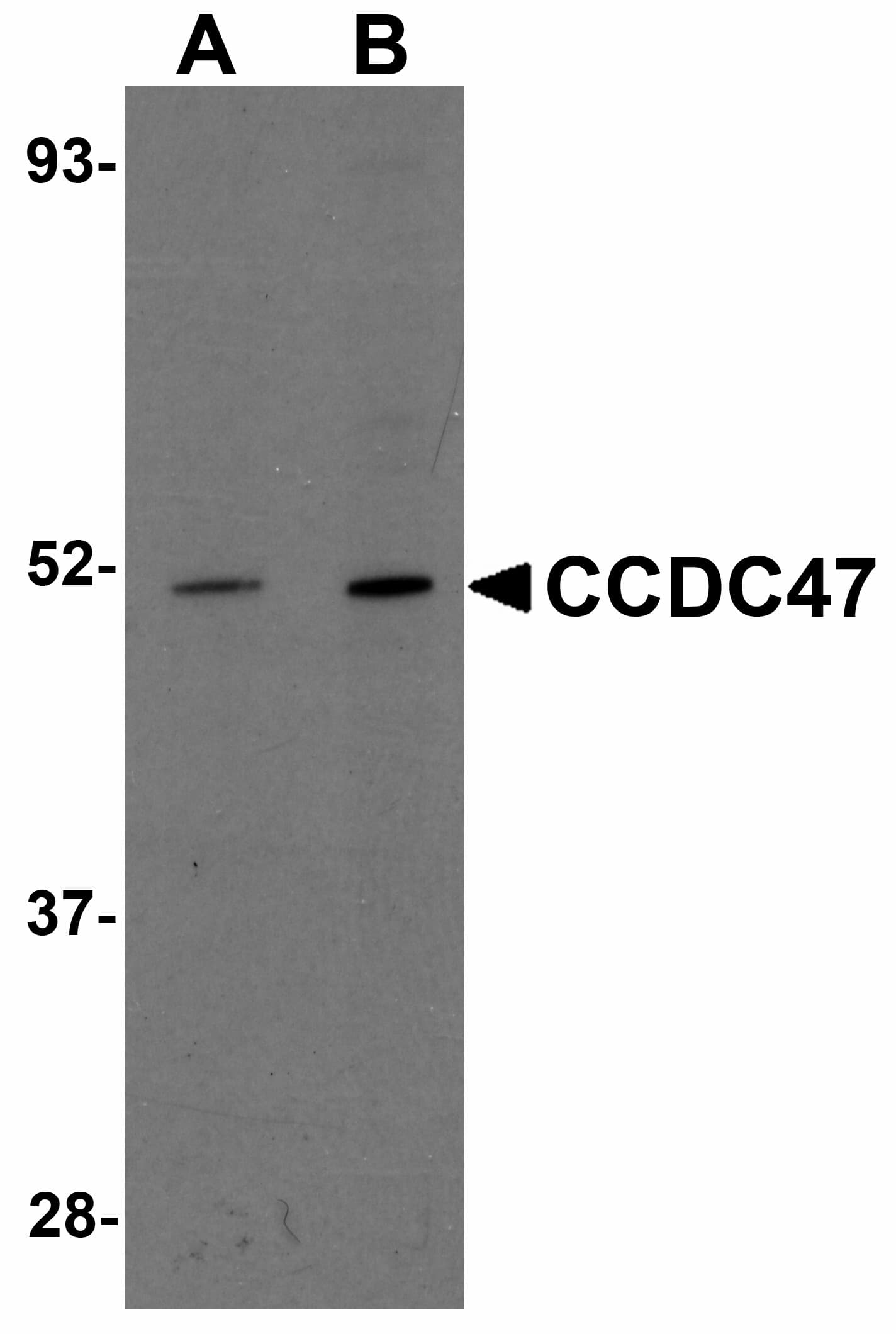 IHC-plus™ CCDC47 Antibody