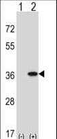 IHC-plus™ GNAQ Antibody (aa52-78)