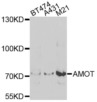 AMOT / Angiomotin Antibody