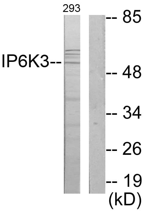 Polyclonal Rabbit anti-Human IP6K3 Antibody (aa201-250, IHC, WB)