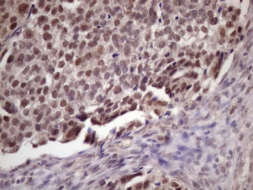 Monoclonal Mouse anti-Human SPT3 / SUPT3H Antibody (clone OTI3D1, Carrier-free, IHC, WB)