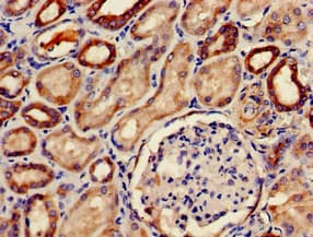PDE2A Antibody