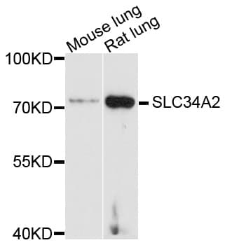Polyclonal Rabbit anti-Human SLC34A2 / NaPi-2b Antibody (WB)